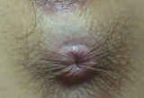 5808360.jpg 
								(26KB)